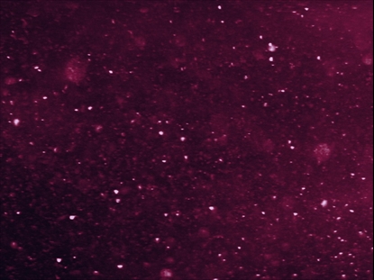 NEW YEAR SPARKLE PINK