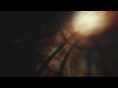 SOARING GLASS RAYS ALT